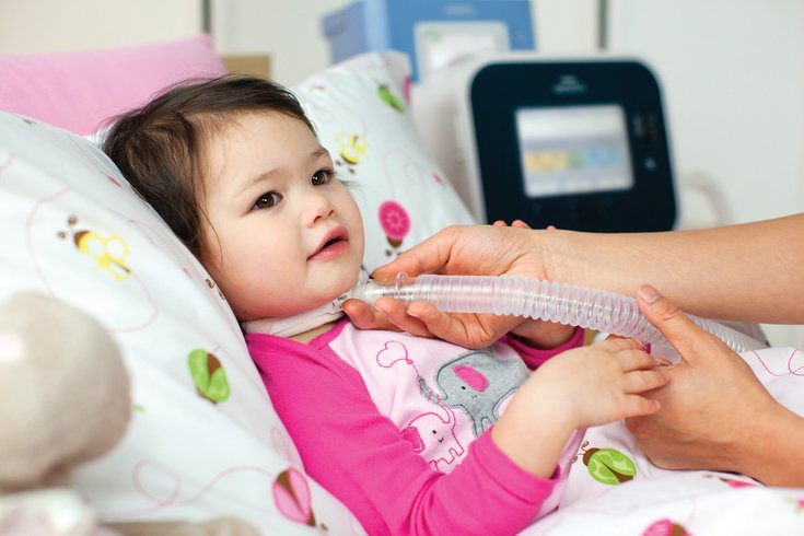 Criança traqueostomizada em uso de ventilador mecânico e assistente de tosse.